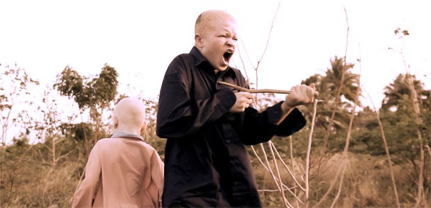 White Shadow: El drama de los albinos en Tanzania